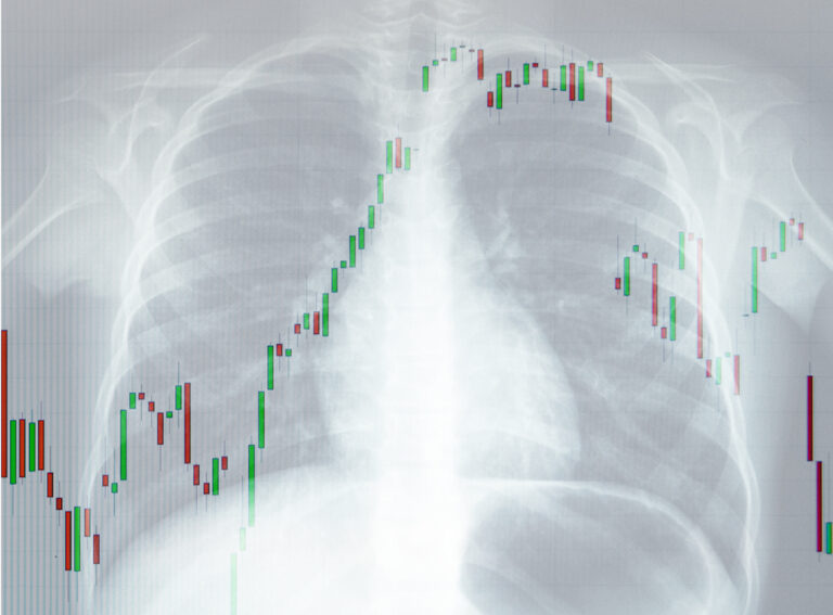 Radiografie OECD: Piața de capital din România