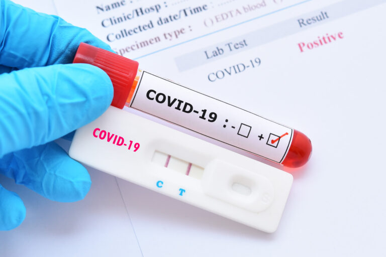 Două milioane de teste, puse la dispoziția școlilor de compania DDS Diagnostic