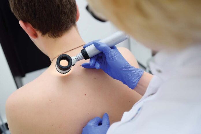 Comunicat Euromelanoma